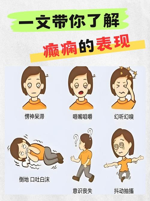 癫痫的临床发作类型有哪些？全身强直－阵挛、失神、单纯部分性发作详解