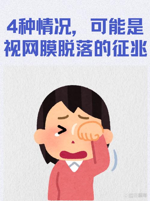 飞蚊症视网膜脱落_视网膜脱落症状_166006