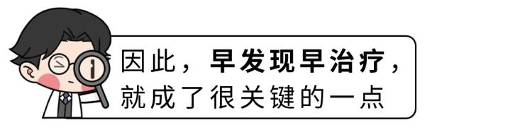 飞蚊症视网膜脱落_166006_视网膜脱落症状